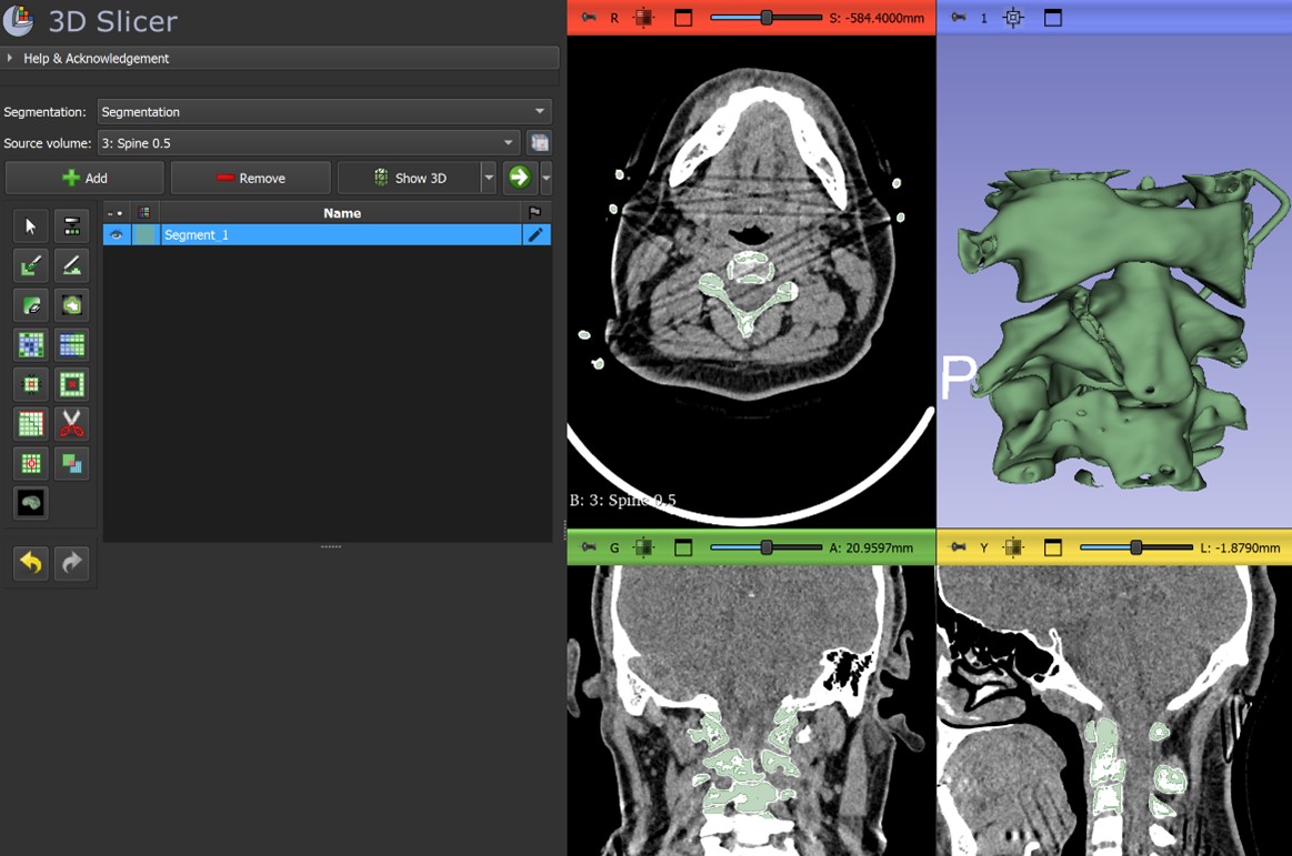 Procesamiento DICOM y segmentación