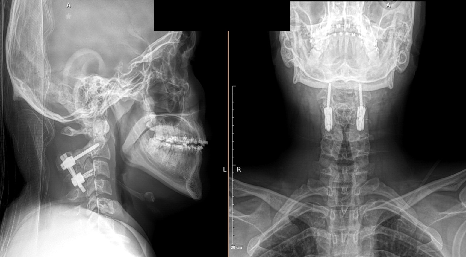 Ejecución en caso real